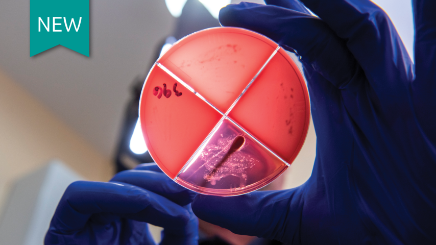 Milk culturing for mastitis
